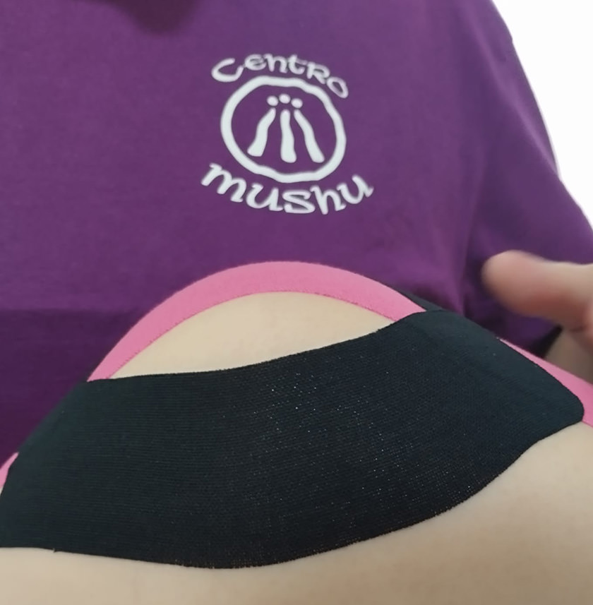 terapia KINESIOTAPING